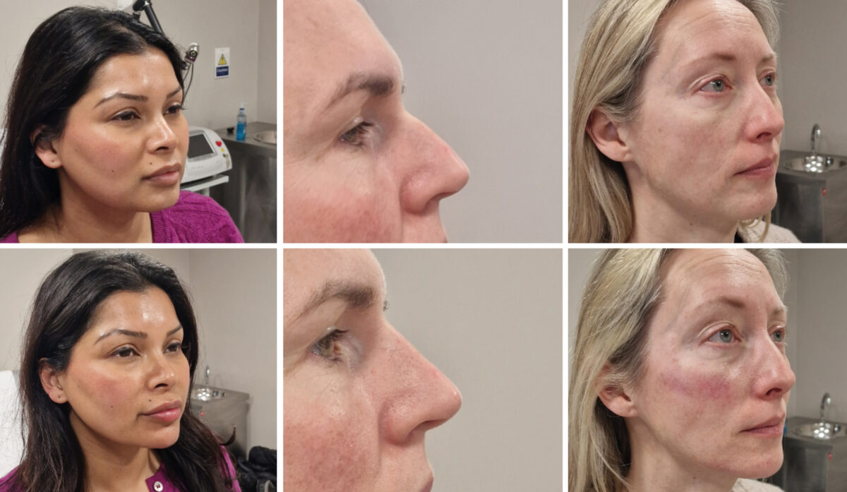 Revital Lab is a doctor-led medical aesthetics and wellness clinic based in Esher, Surrey, offering personalised treatments such as anti-wrinkle injections, dermal fillers and health checks with a focus on holistic, patient-centred care.