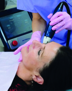 Radiofrequency Microneedling